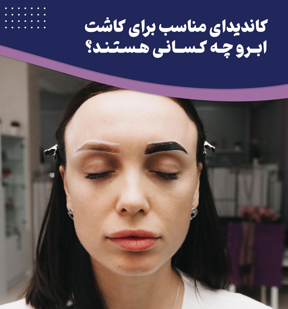 کاشت ابرو برای چه کسانی مناسب است