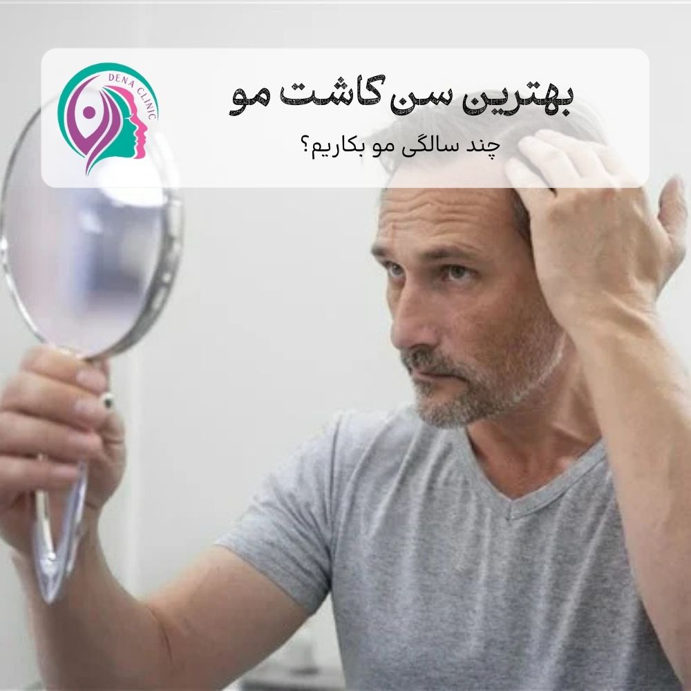 بهترین سن کاشت مو چه سنی است؟