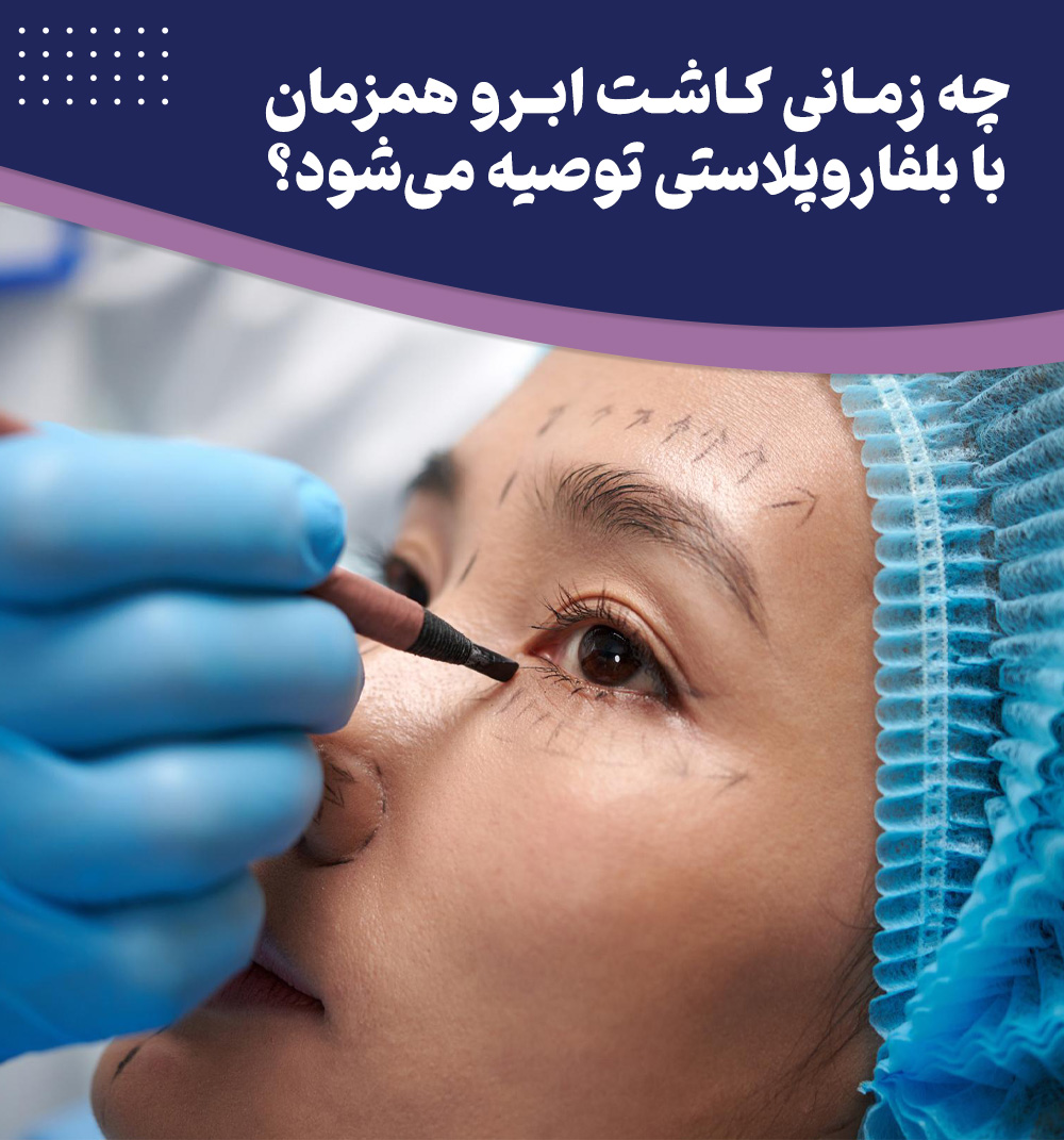آیا کاشت ابرو همزمان با بلفاروپلاستی امکان پذیر است