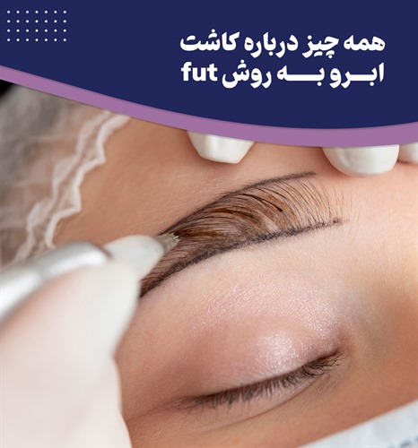 کاشت ابرو به روش FUT چگونه است