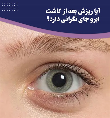 دلیل ریزش ابروها بعد از کاشت چیست