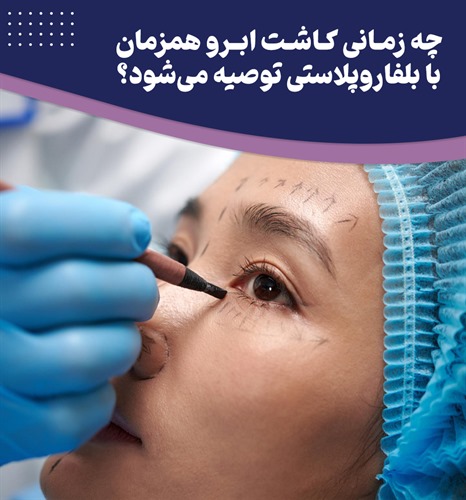 آیا کاشت ابرو همزمان با بلفاروپلاستی امکان پذیر است