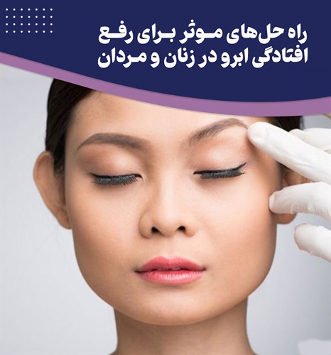 چگونه افتادگی ابرو را در زنان و مردان درمان کنیم