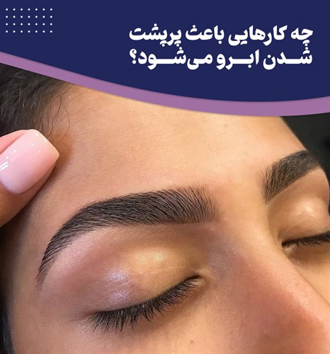 8 روش برای داشتن ابروهای پرپشت و خوش فرم