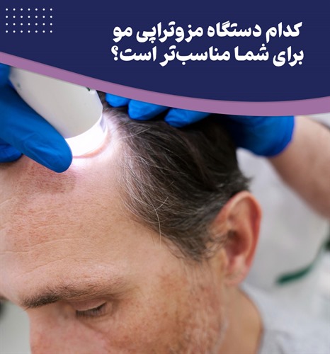 مقایسه و بررسی انواع دستگاه مزوتراپی مو