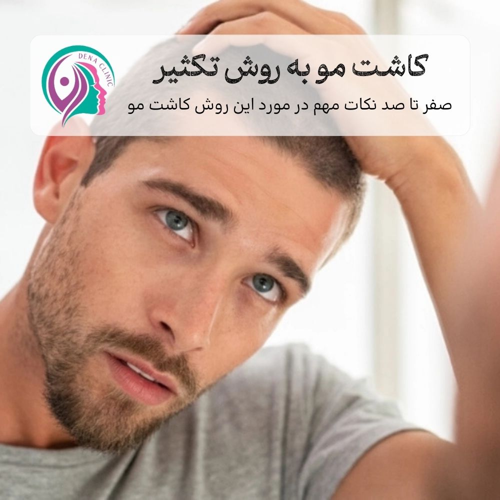 کاشت مو به روش تکثیری