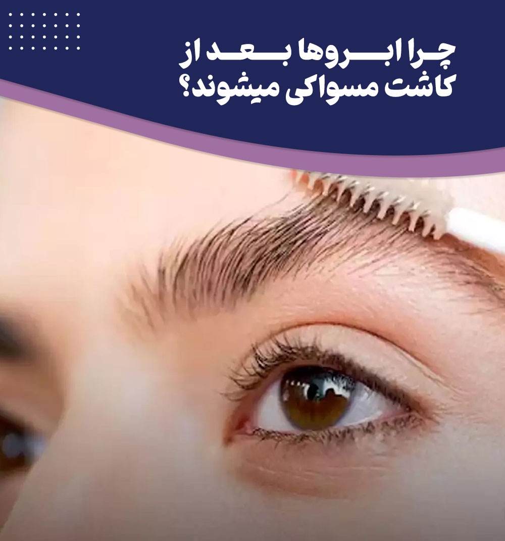 علت مسواکی شدن ابرو بعد از کاشت به همراه روش های پیشگیری از آن