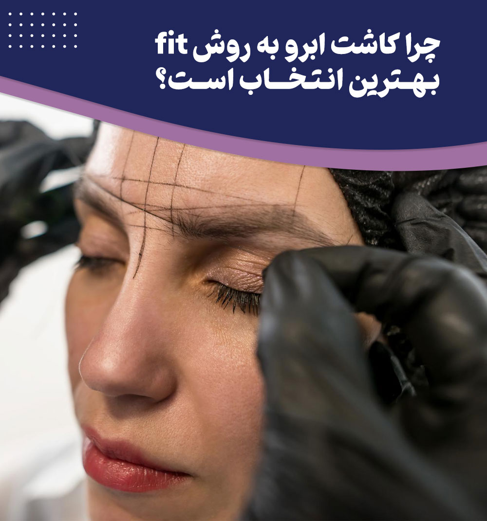 نکاتی که باید قبل و بعد از کاشت ابرو به روش FIT بدانید