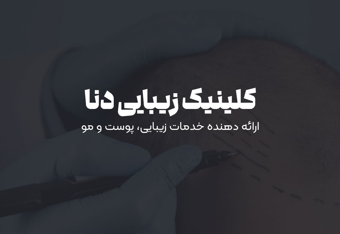 بنر نمونه کلینیک زیبایی شیراز
