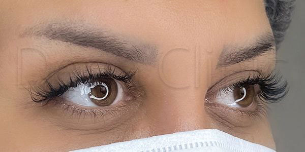 نمونه کار کاشت ابرو
