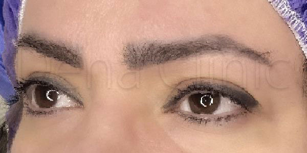 نمونه کار کاشت ابرو