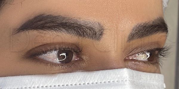 نمونه کار کاشت ابرو