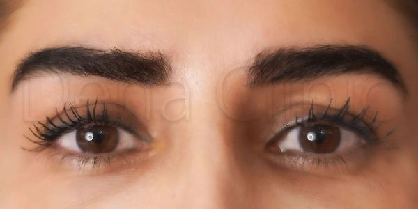 نمونه کار کاشت ابرو