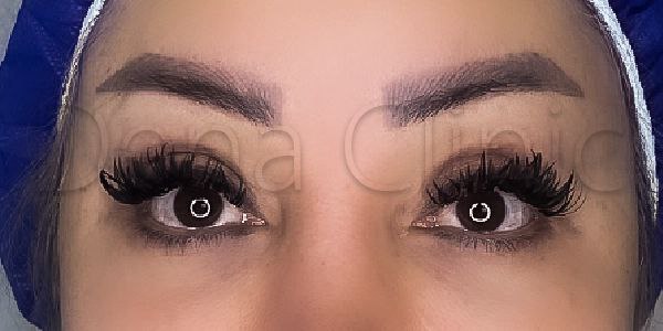 نمونه کار کاشت ابرو