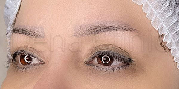 نمونه کار کاشت ابرو