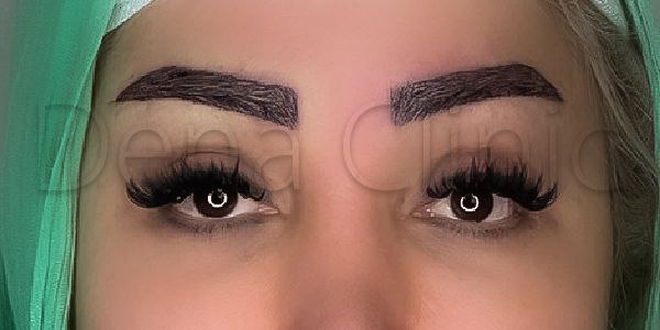 نمونه کار کاشت ابرو