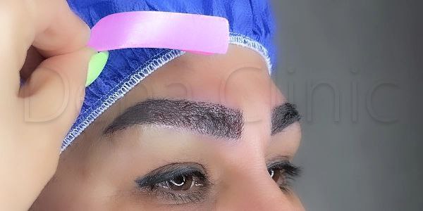 نمونه کار کاشت ابرو