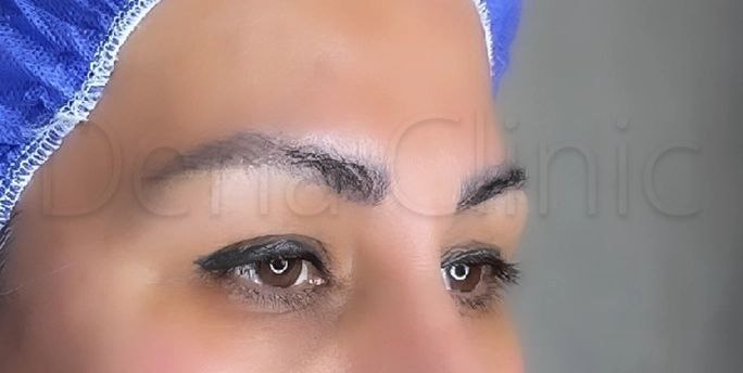 نمونه کار کاشت ابرو