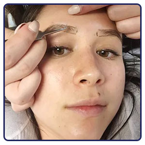 استفاده از کاشت ابروهای مصنوعی، روش پرپشت شدن ابرو بدون جراحی