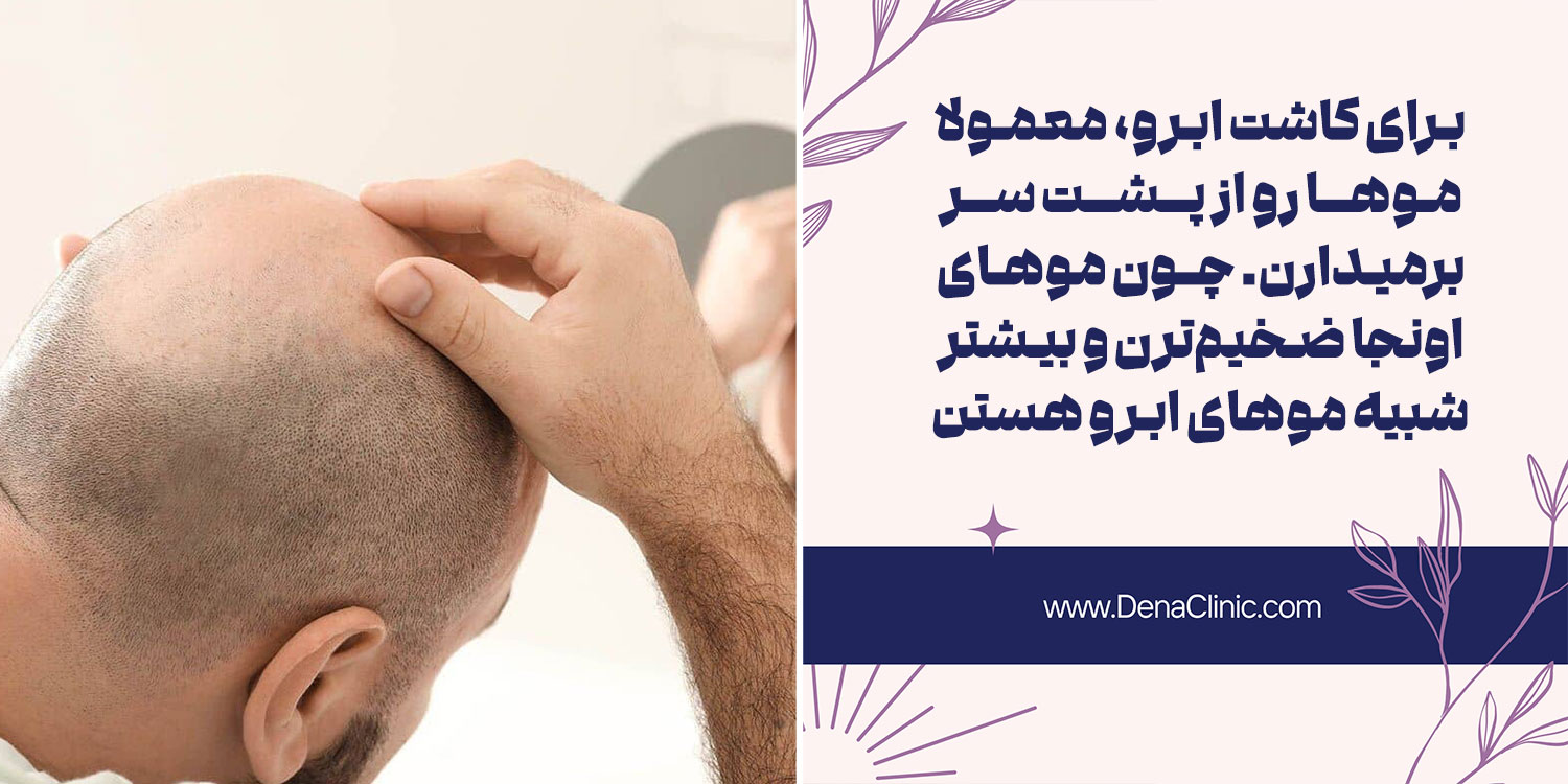 برای کاشت ابرو از کجا مو بر میدارند؟