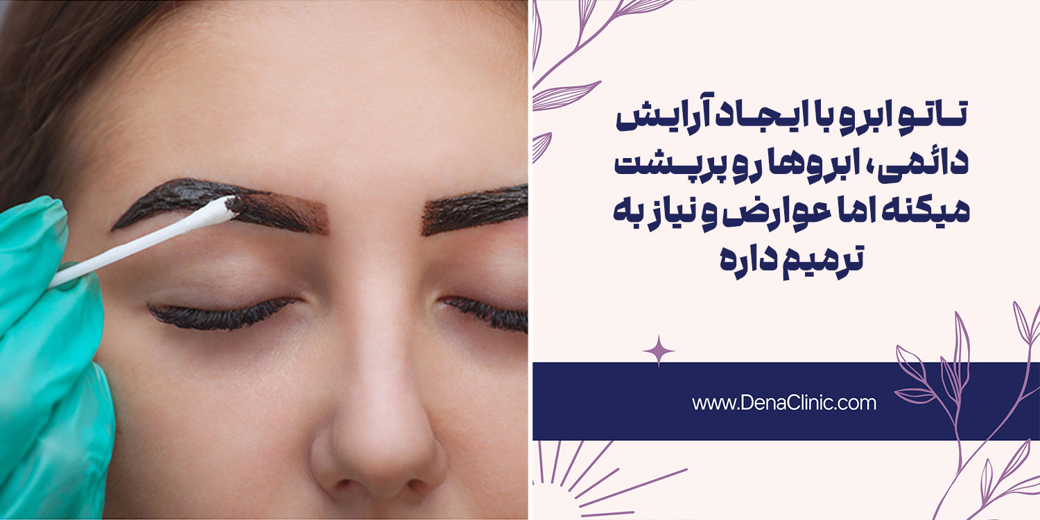 مزایا و معایب تاتو ابرو را بدانید!