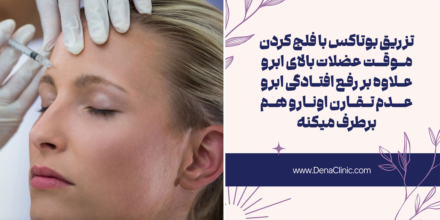 بوتاکس ابرو یکی از روش های درمان افتادگی ابرو