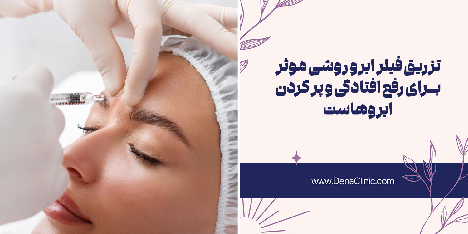 فیلر ابرو یکی از روش های درمان افتادگی ابرو