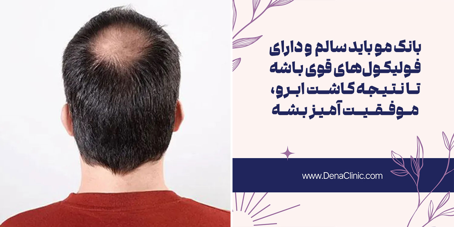 تفاوت بانک مو برای کاشت ابرو در مردان و زنان