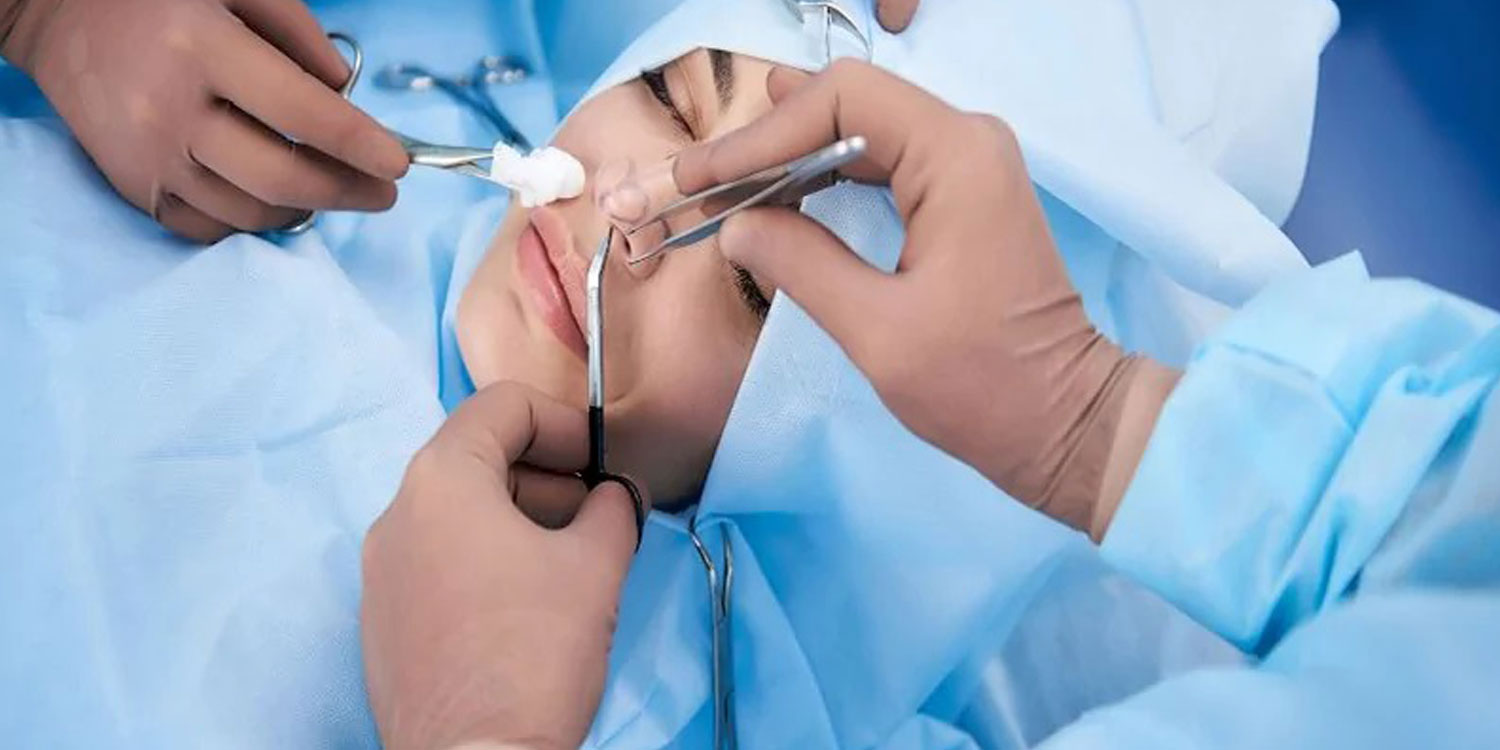 جراحی زیبایی بینی یا رینوپلاستی یکی از انواع جراحی های زیبایی