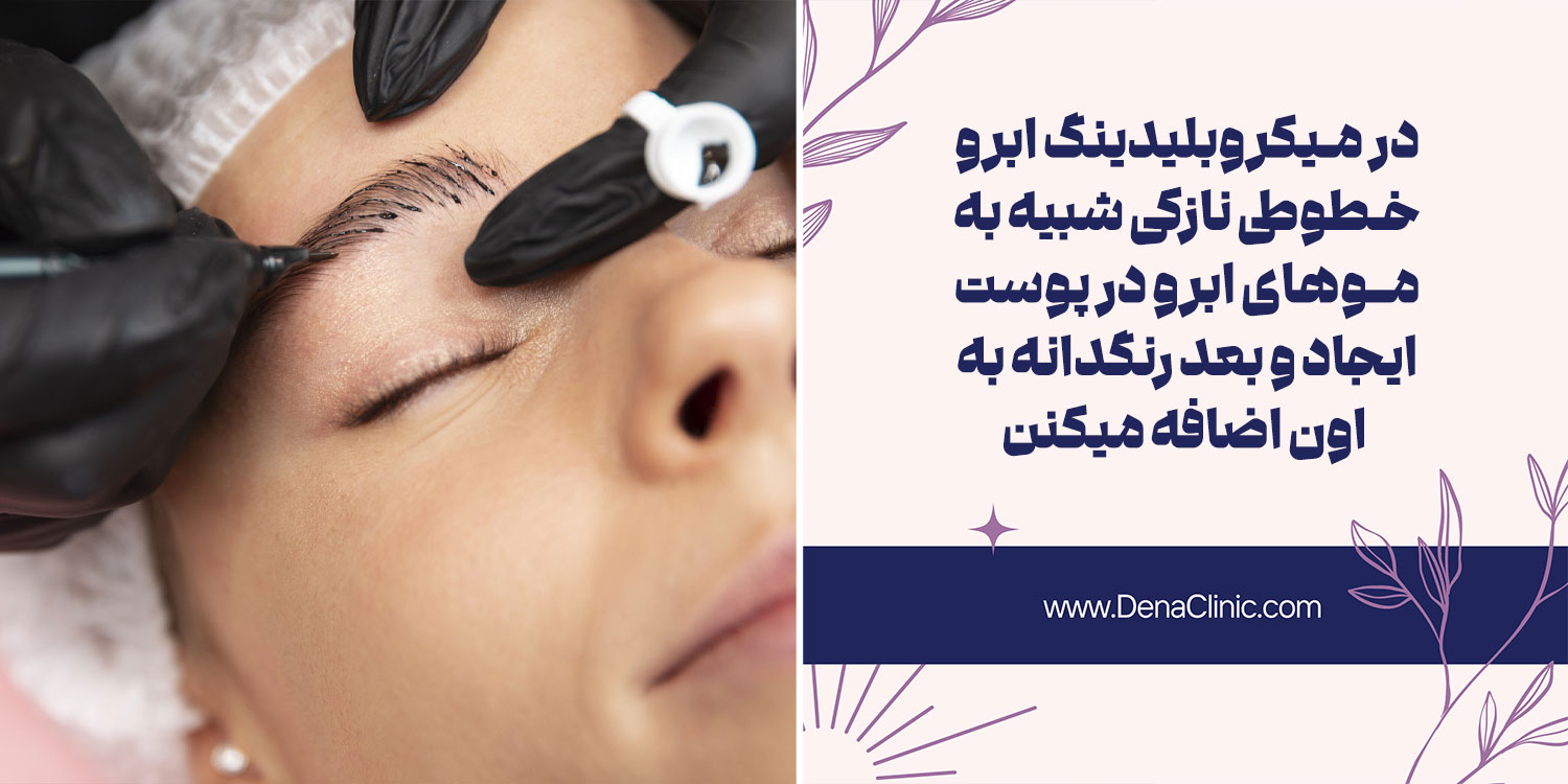 طریقه انجام میکروبلیدینگ ابرو چگونه است؟