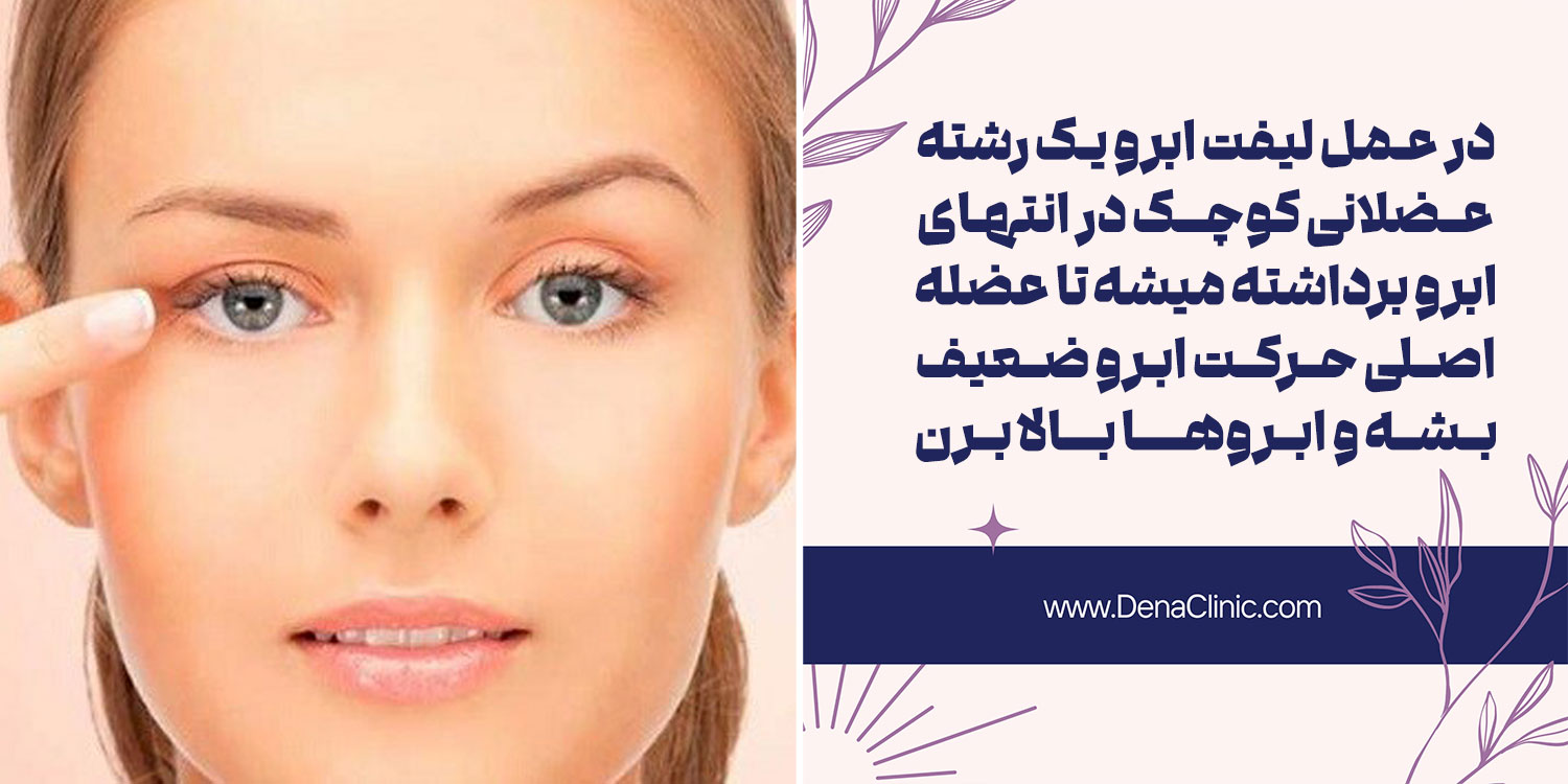 قطع عضلات پایین آورنده پیشانی یکی از روش های کم تهاجمی برای لیفت ابرو
