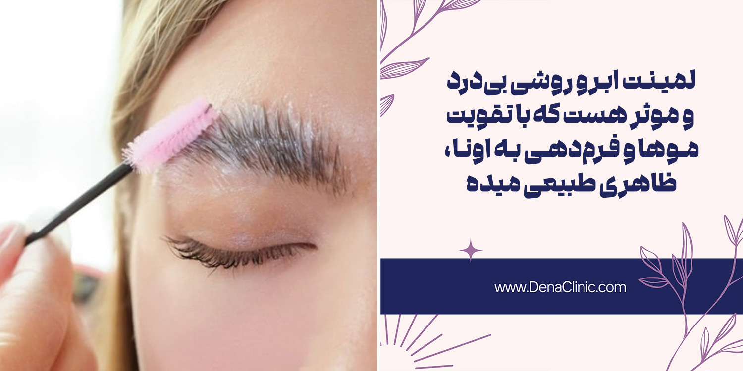 لمینت ابرو یکی از راه های داشتن ابرو زیبا و خوش فرم