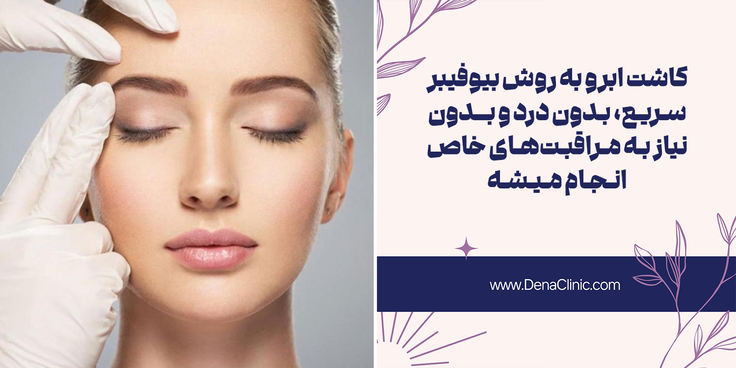 مزایای کاشت ابرو به روش BIO FIBER