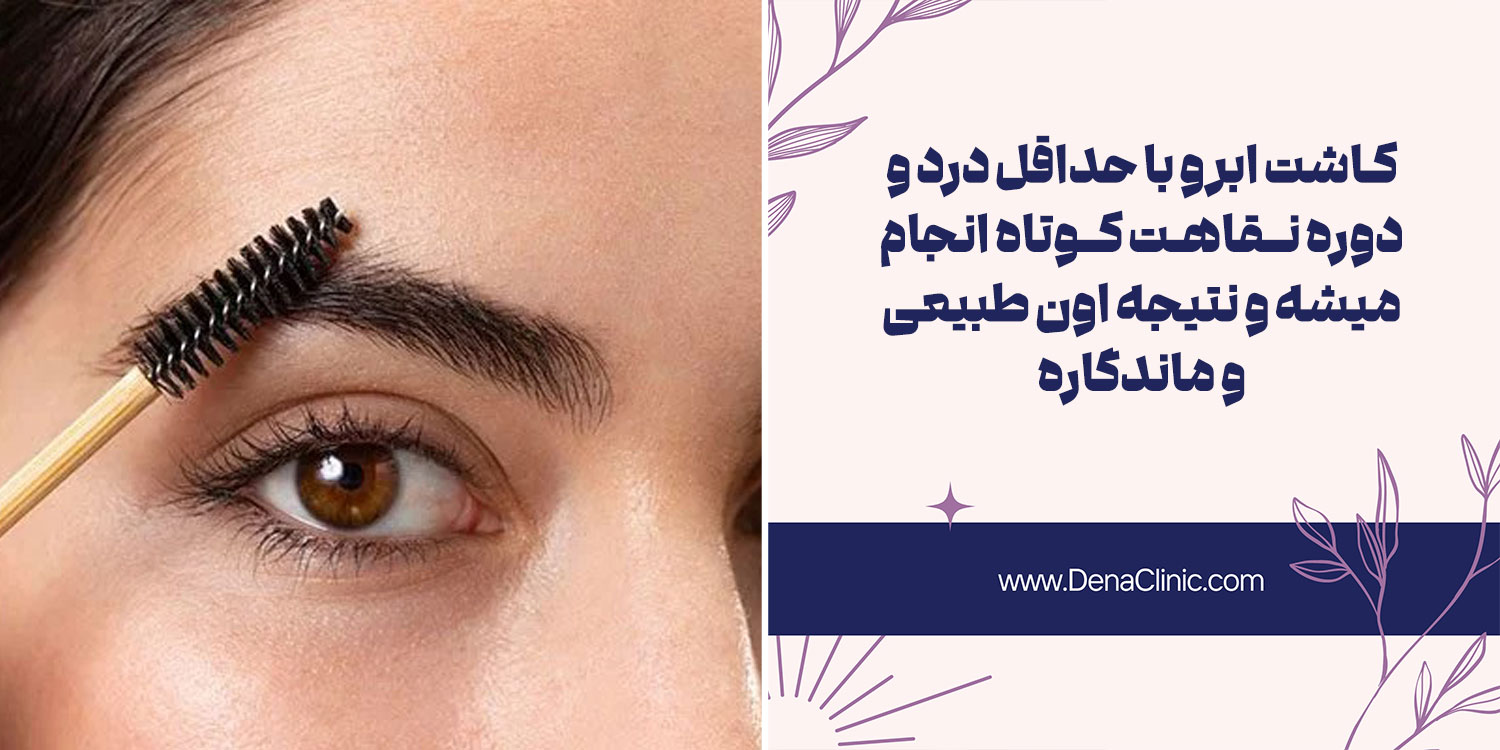 مزایا و معایب کاشت ابرو را بدانید