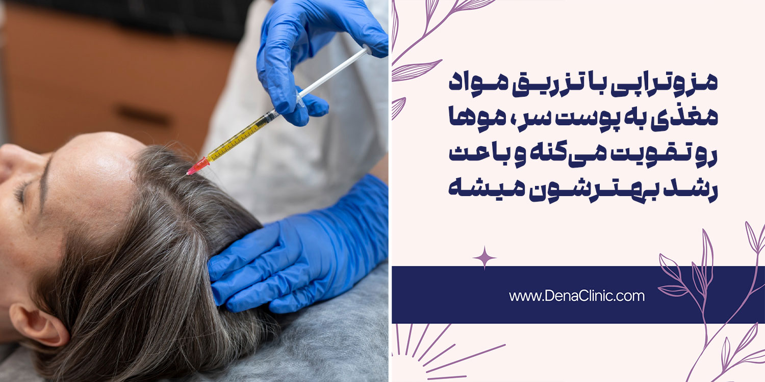 مزوتراپی و بهترین دستگاه برای مزوتراپی مو