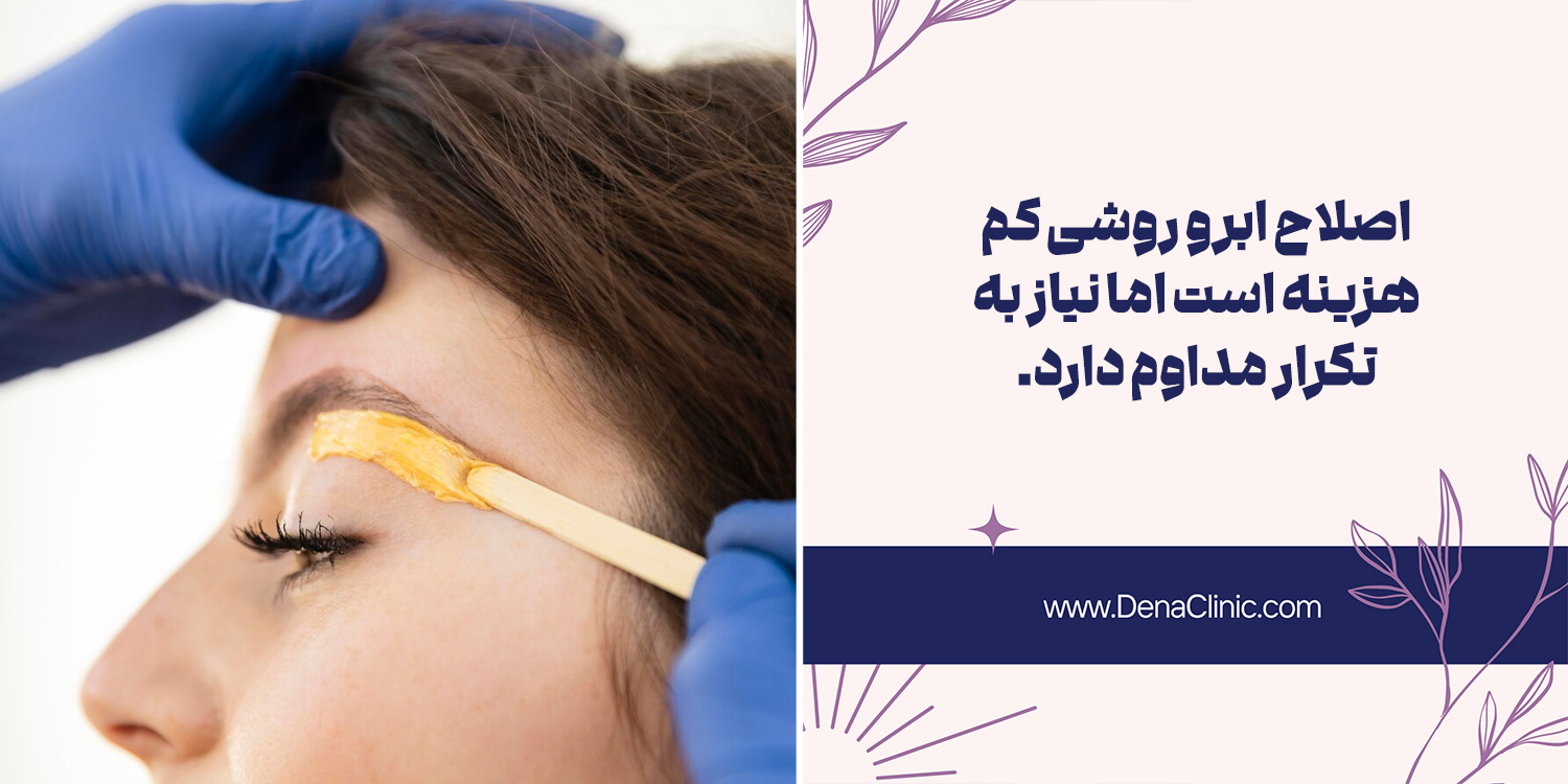 اصلاح ابرو روشی تکراری