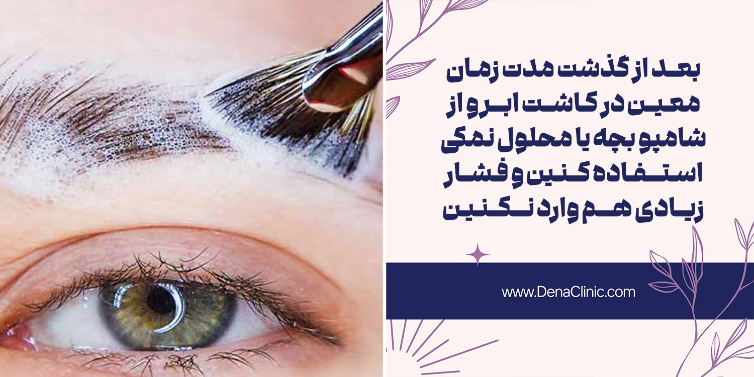 روش صحیح شستشوی ابروها پس از کاشت را بدانید!