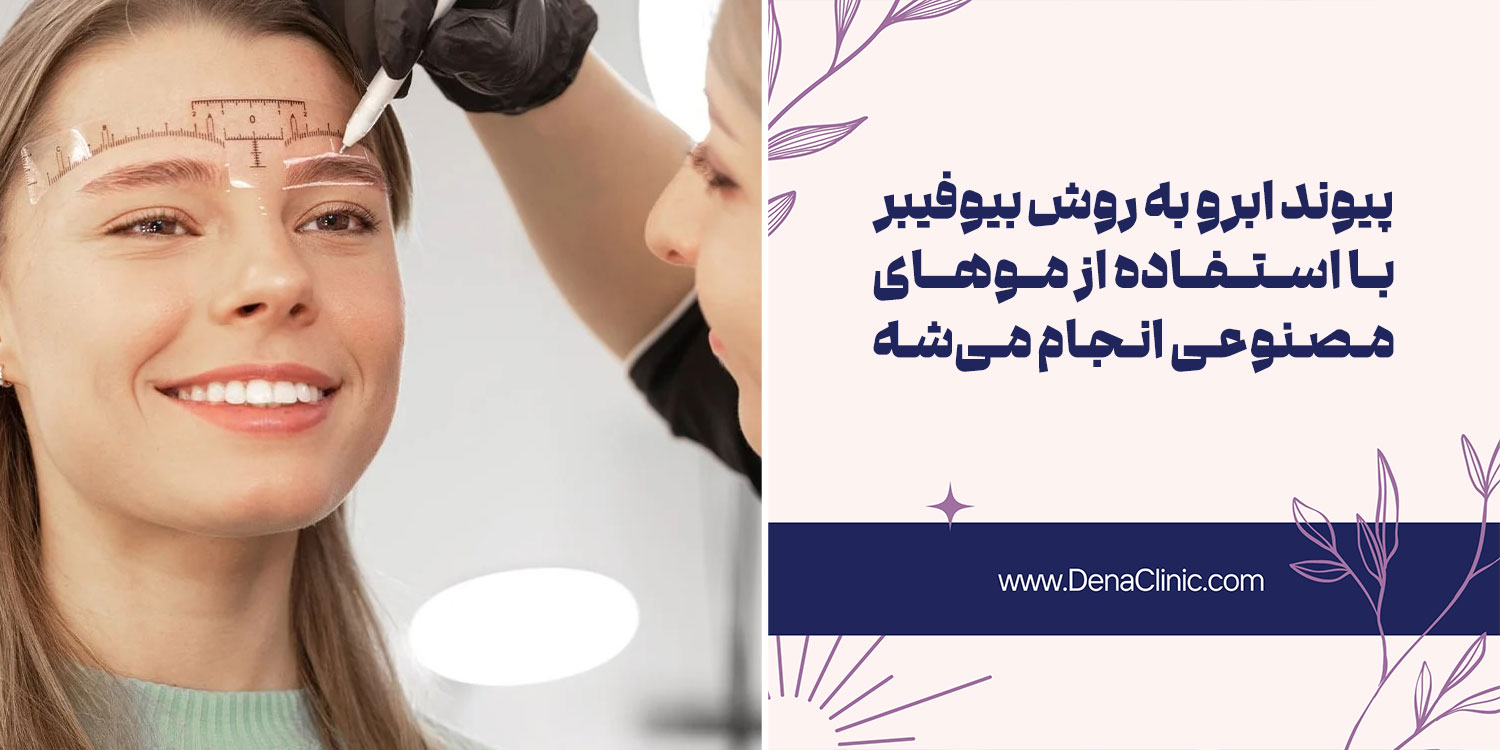 نحوه کاشت ابرو به روش BIO FIBER