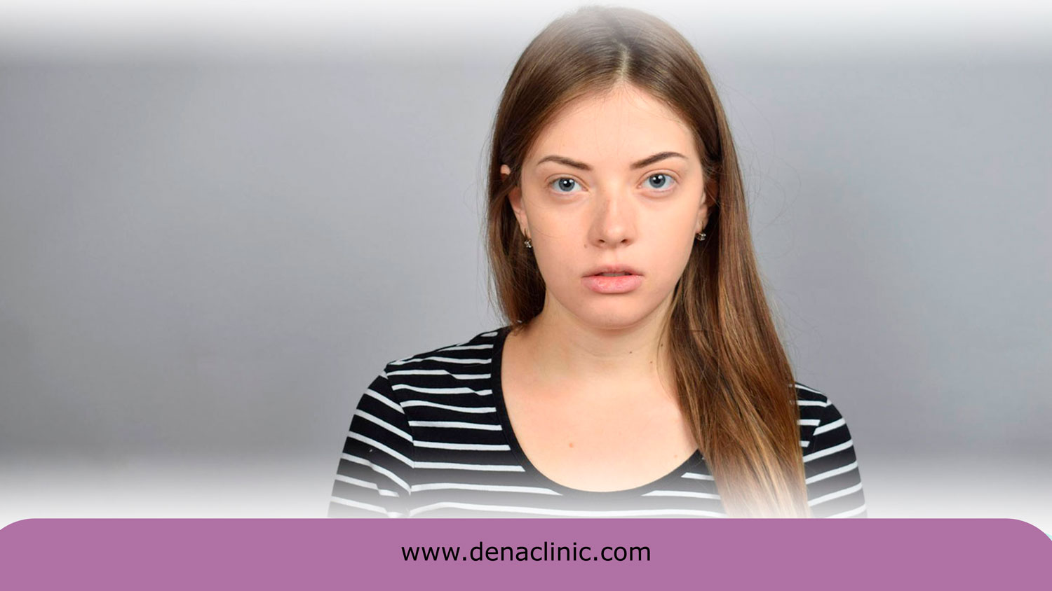 چه کسانی برای کاشت ابرو به روش fit مناسب هستند