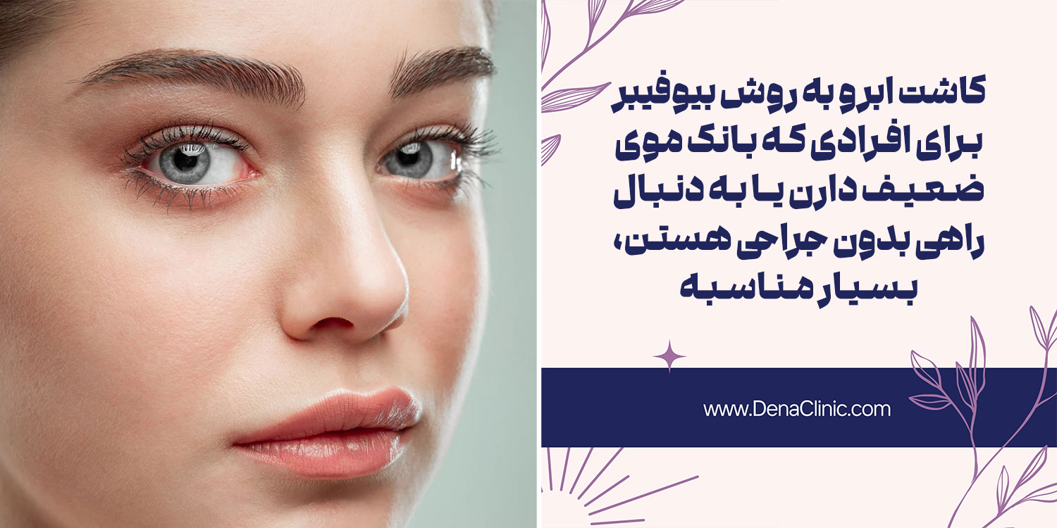 کاشت ابرو با روش بیوفیبر BIO FIBER چیست