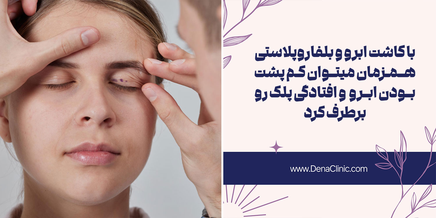 کاشت ابرو همزمان با بلفاروپلاستی چیست؟