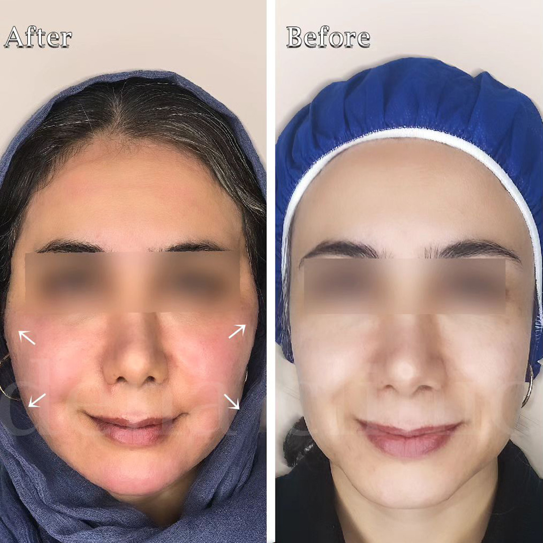 نمونه کارهای کانتورینگ صورت 1