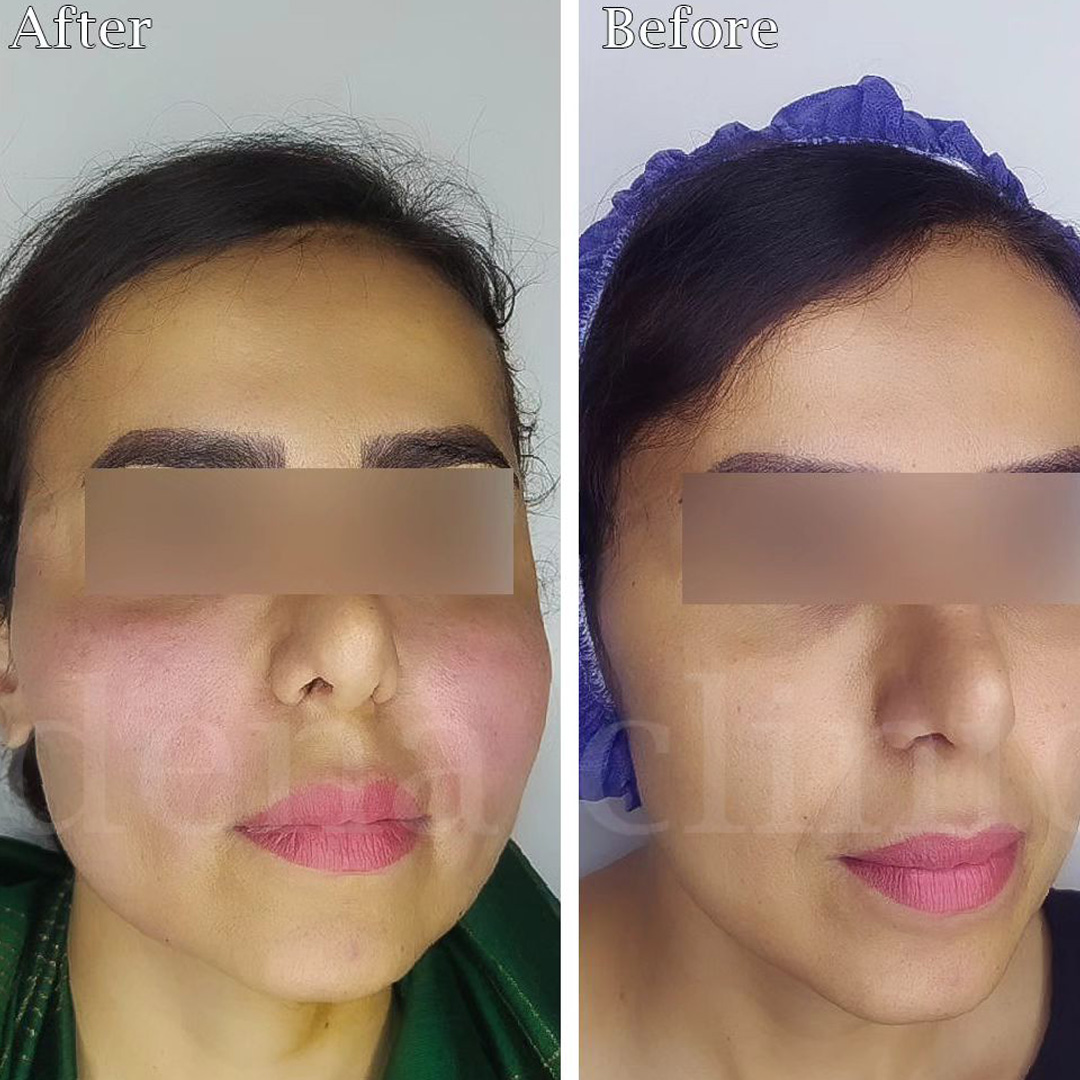 نمونه کارهای کانتورینگ صورت 2