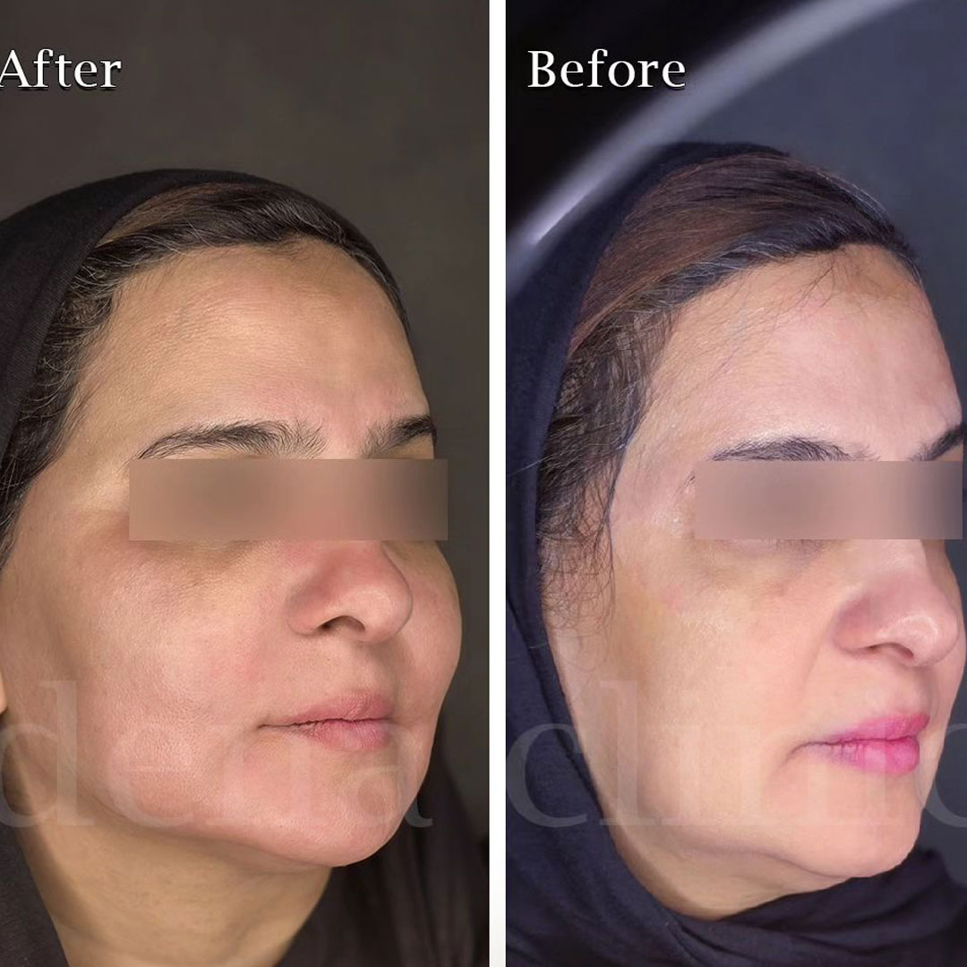 نمونه کارهای کانتورینگ صورت 6