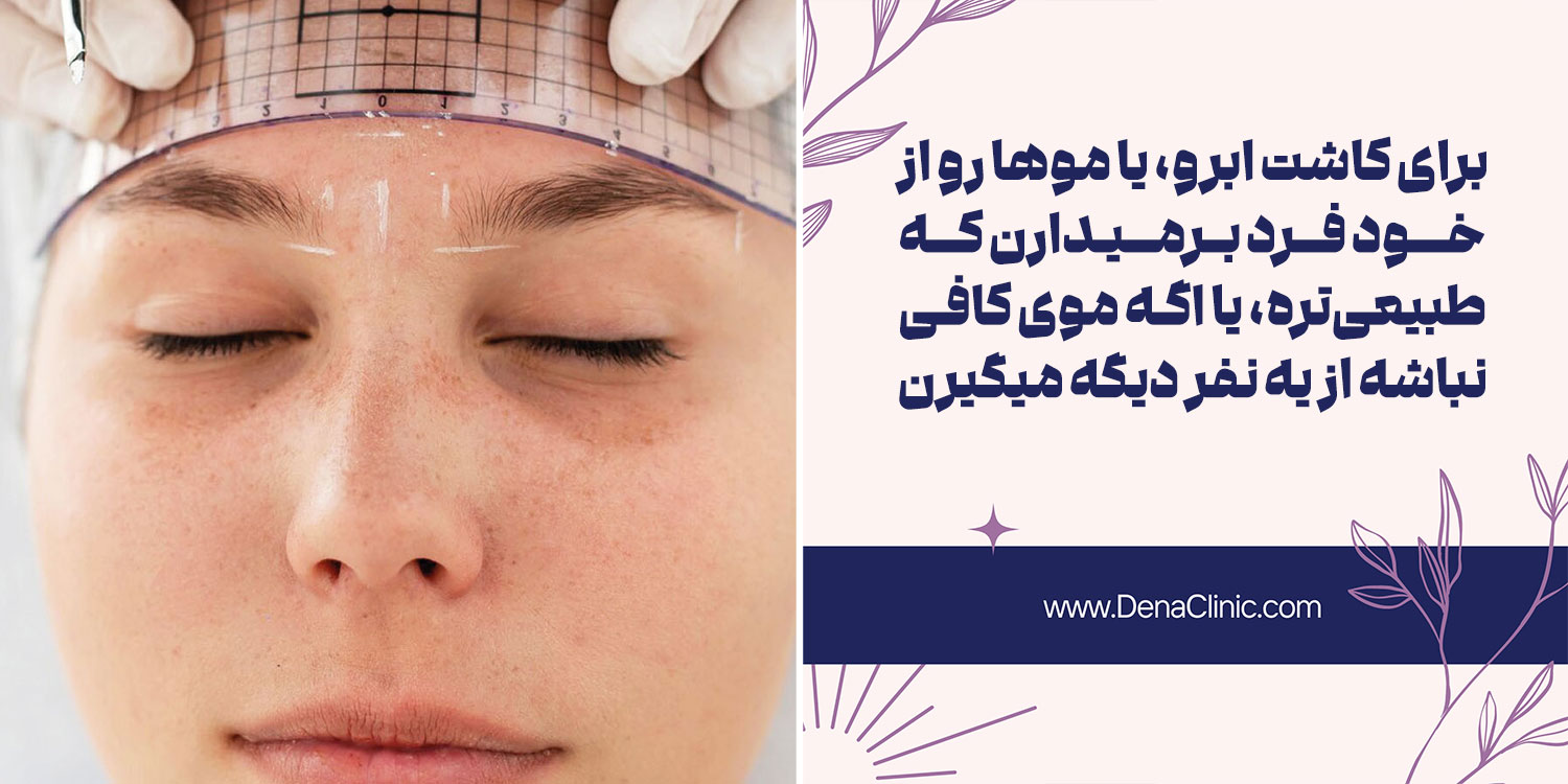 2 منبع اصلی برای کاشت ابرو