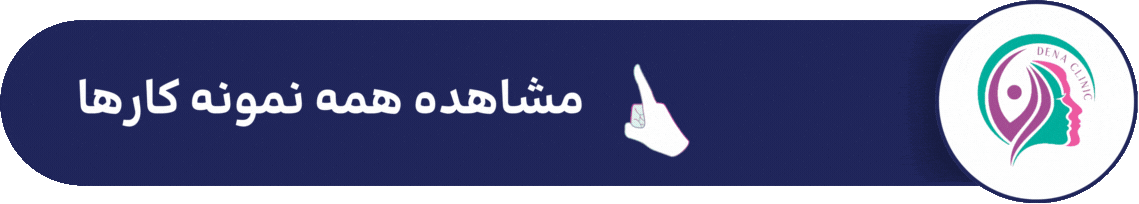 مشاهده نمونه کارهای کاشت ریش و سبیل